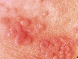 皮炎子吃瓜频道,揭秘娱乐圈幕后故事，带你领略明星真实生活